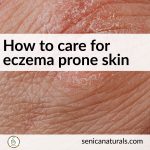 How to care for eczema prone skin square